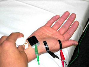 Elektromyografia EMG